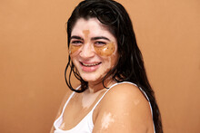 Vitiligo Skin Woman Smiling Using Eye Pad Mask