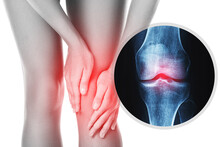 Knee And And X-ray Effect With An Injured Joint
