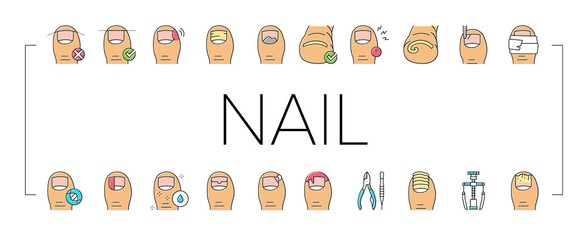 Wall Mural - Ingrown Nail Disease Collection Icons Set Vector .