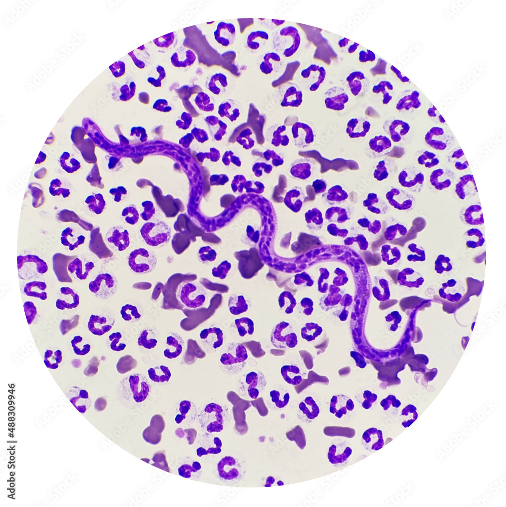 Microfilariae are not sheathed in the blood smear of a dog. Light  microscope of heartworms, Dirofilaria immitis. Stock Photo | Adobe Stock, image size:999x1000