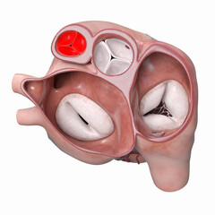 Poster - 3d rendered illustration of the heart valves - the pulmonary valve