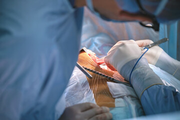 Wall Mural - Closeup of professional doctor hands operating a patient during open heart surgery in surgical room. Healthcare and medical intervention concept