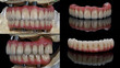 dental collage with ceramic and titanium prostheses on models on a black background