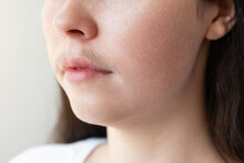 A Close-up Of A Woman's Face With A Mustache Over Her Upper Lip. The Concept Of Hair Removal And Epilation
