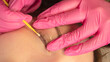 Woman on the procedure for eyelash extensions, lamination in beauty salon. Cosmetologist applying glue on woman's lashes. Close-up of girl face during lash lift laminating botox set. 