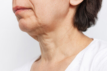 the lower part of elderly woman's face and neck with signs of skin aging isolated on a white backgro