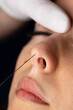 © Emir - Female cosmetology in a beauty salon. Doctor nose tip correction and lifting.