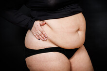 A Woman Holds With Her Hands Folds Of Skin On A Thick Belly On A Black Background. Obese Person