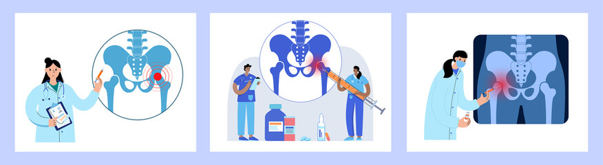 Poster - Hip joint injection