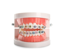 Model Of Jaw With Braces Isolated On White Background