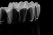 creative dental photo on the relief of a zircon prosthesis on a black background