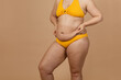 © Юля Бурмистрова - Cropped image of overweight woman, tucking, hiding fat naked big excessive belly with navel in yellow pants. Dangling down stomach, big size tummy. Drag away of abdomen. Go on diet, liposuction