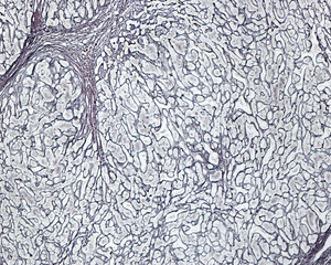 Poster - Human liver. Cirrhosis. Silver stain