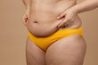 © Юля Бурмистрова - Cropped image of overweight woman, tucking, hiding fat naked big excessive belly with navel in yellow pants. Dangling down stomach, big size tummy. Drag away of abdomen. Go on diet, liposuction