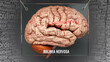 Bulimia nervosa anatomy - its causes and effects projected on a human brain revealing Bulimia nervosa complexity and relation to human mind. Concept art, 3d illustration
