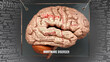 Nightmare disorder anatomy - its causes and effects projected on a human brain revealing Nightmare disorder complexity and relation to human mind. Concept art, 3d illustration