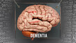 Dementia anatomy - its causes and effects projected on a human brain revealing Dementia complexity and relation to human mind. Concept art, 3d illustration