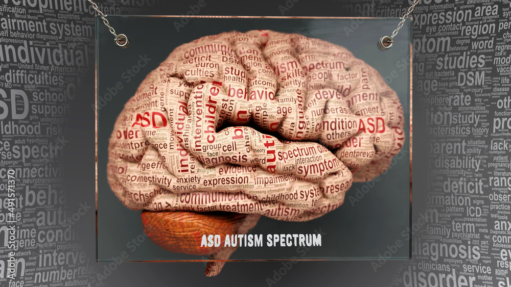 Ilustración de Stock Asd autism spectrum anatomy - its causes and ...