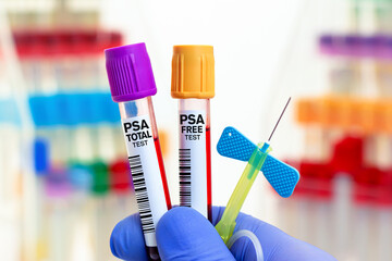 Wall Mural - doctor with Blood tubes and needle for PSA Free and PSA Total test in biochemistry lab. Blood samples of patient for PSA Free and PSA Total test in laboratory