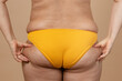 © Юля Бурмистрова - Cropped image of overweight fat naked woman bottom buttocks, tucking, hiding excess fat in yellow pants. Dangling down, ptosis. Big size. Lifting flabs. Go on diet, sport. liposuction, cellulite