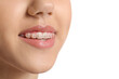 © Pixel-Shot - Teeth of young woman with dental braces on white background, closeup