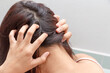 Women itching scalp