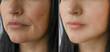 © tanya78 - woman face wrinkles before and after