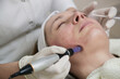 Mesotherapy. Woman having dermapen facial treatment.
Micro needle cosmetic treatment at dermatologist.