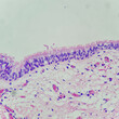Camera photo of benign respiratory epithelium, showing cilia along luminal surface, magnification 400x, photograph through a microscope