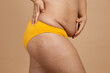 © Юля Бурмистрова - Cropped image of overweight woman, tucking, hiding fat naked big excessive belly with navel in yellow pants. Dangling down stomach, big size tummy. Drag away of abdomen. Go on diet, liposuction
