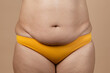 Cropped image of overweight fat pregnant woman sag stomach with obesity, excess fat in yellow pants. Fast weight loss. Stomach flabs. Dehydrated, flabby skin swelling, losing turgor collagen. Surgery
