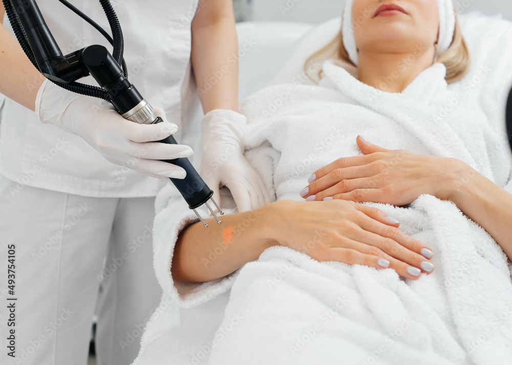 A young girl gets carbon peeling for the skin of her hands in a beauty salon. Laser pulses cleanse the skin. Hardware cosmetology. The process of photothermolysis, warming the skin.