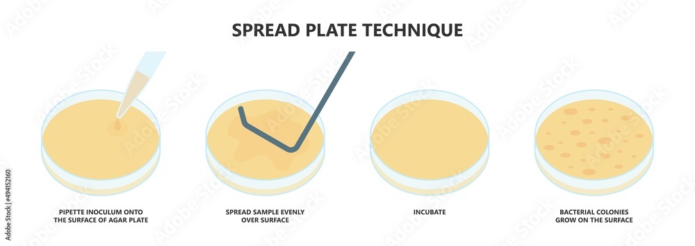 Surface. Spread Method Agar plate method cell colony growth loop Bacteria Test blood stool ...