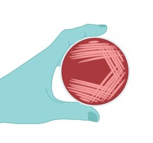 Agar plate method cell colony growth loop Bacteria Test blood stool urine mucus spinal fluid Sepsis Lab microbe fungi virus exam throat strep petri dish pour c diff germs Inoculate bacteriological