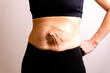 cropped woman dressed in black top and black leggings. Diastasis and umbilical hernia after pregnancy