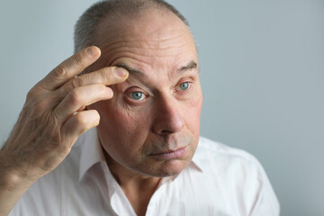 Wall Mural - close-up of face of bald mature man 60 years old looks in mirror, critically examines face, skin, wrinkles, upset because age-related changes, midlife crisis, hair loss, selective focus