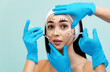 © _KUBE_ - Portrait of a pretty young woman with surgical markings on her face. Hands of doctors in medical gloves lean syringes against a woman's face. Concept of cosmetic injections