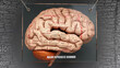 Major depressive disorder anatomy - its causes and effects projected on a human brain revealing Major depressive disorder complexity and relation to human mind. Concept art, 3d illustration