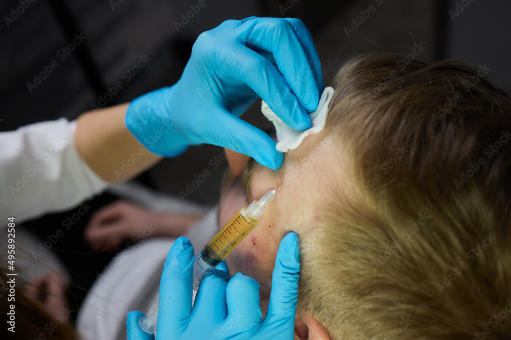 Injection at spa salon. Doctor hands in gloves. Closeup. Pretty male ...