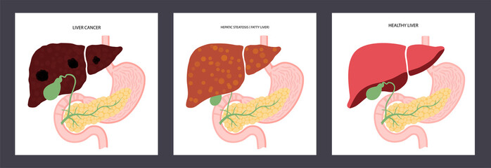 Sticker - Liver disease concept