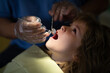 © Volodymyr - Cute boy sitting at dental chair with open mouth during oral checking up with doctor. Visiting dentist office. Kids stomatology. Oral kids cavity.