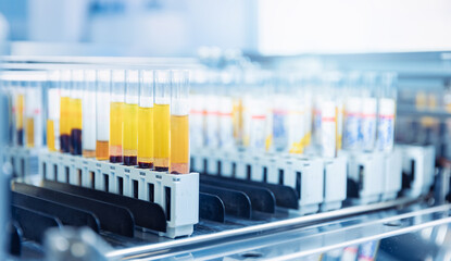 Wall Mural - test tubes with blood for automatic biochemical analyzer. medical lab equipment biomedical banner bl