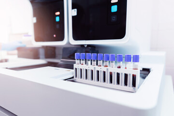 Wall Mural - medical blood tests on automatic modern equipment of laboratories