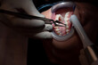 © Bisual Studio/Stocksy - Crop dentists putting tooth filling to patient