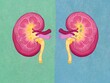 © kkgas/Stocksy - Kidney cross-section showing kidney stones