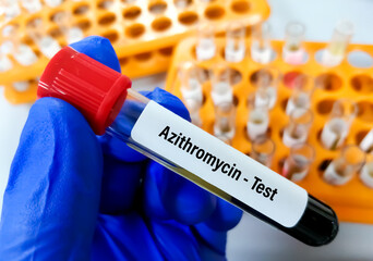 Sticker - Blood sample on scientist hand for Azithromycin test, to set therapeutic range of Azithromycin.