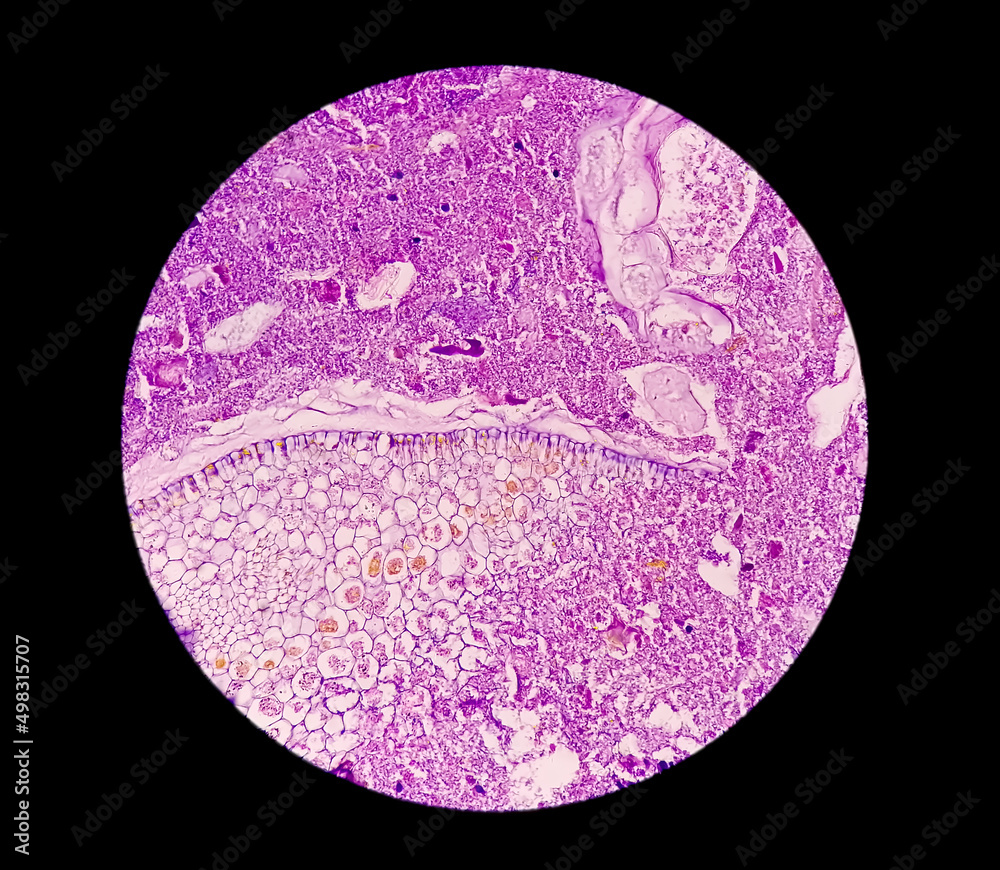 Scopic Appendix Microscopic image (photomicrograph) of a cross section of an appendix ...