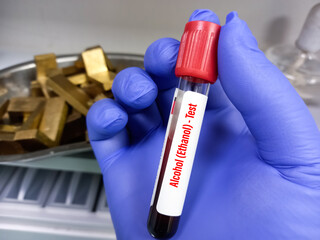 Canvas Print - Blood sample tube with sample for alcohol testing