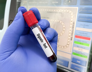 Poster - Blood sample for Digoxin test, Digoxin is a medicine called a cardiac glycoside. It is used to treat certain heart problems.