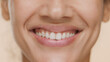© pavel_dp - Extreme close-up of young African American woman's wide smile on beige background | Teeth health concept